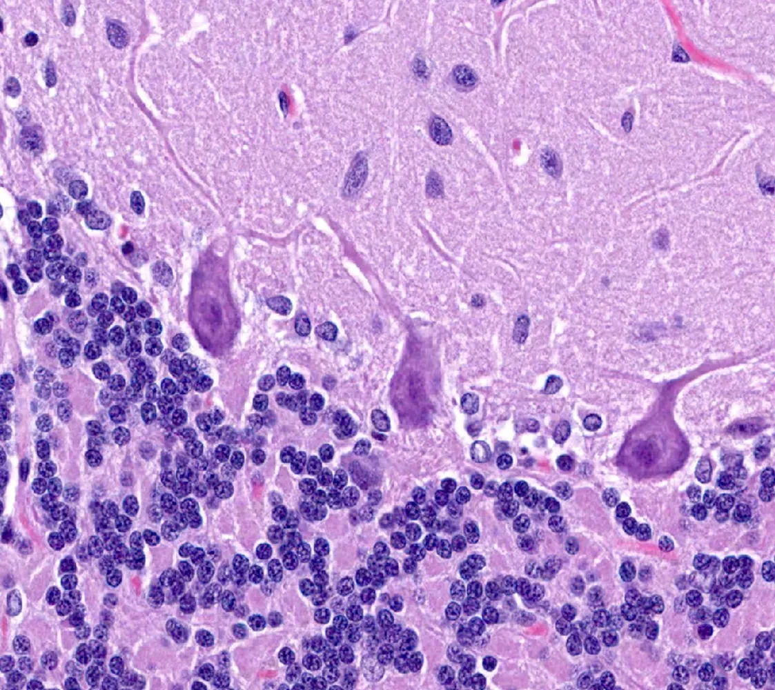 Microscopic image of Purkinje neurons of cerebellum